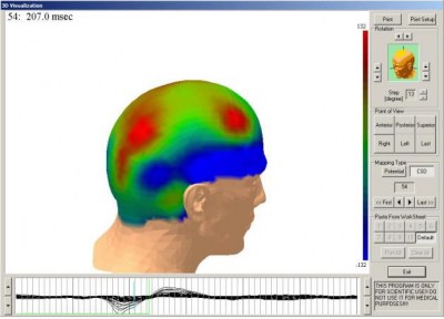 eeg-brain-mapping-1613740965